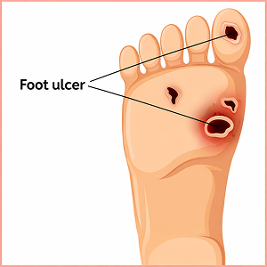 Maladies infectieuses